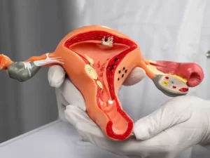 علائم سرطان دهانه رحم