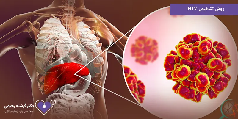 روش تشخیص HIV