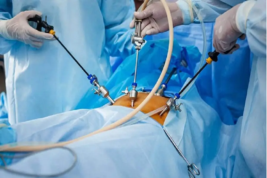 جراحی لاپاراسکوپی رحم