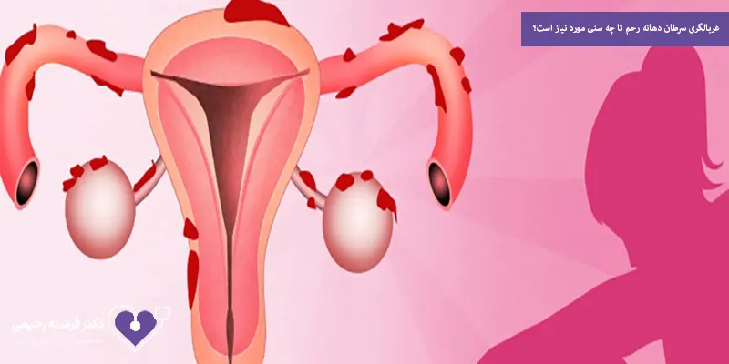 غربالگری سرطان دهانه رحم تا چه سنی مورد نیاز است؟