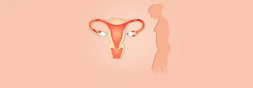 بیماری اندومتریوز