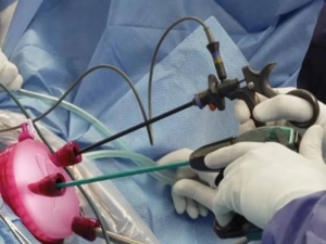 جراح هیسترکتومی بدون باز شدن شکم