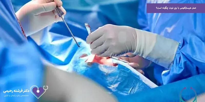 عمل هیسترکتومی با وی نوت چگونه است؟