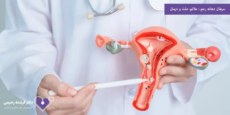 سرطان دهانه رحم علائم، علت و درمان