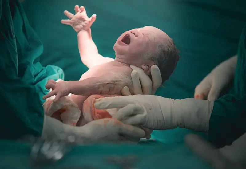 درد زایمان طبیعی