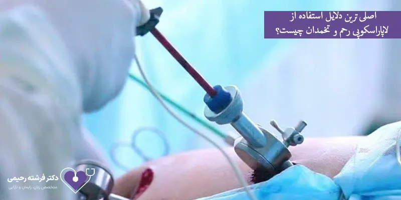 اصلی-ترین-دلایل-استفاده-از-لاپاراسکوپی-رحم-و-تخمدان-چیست؟