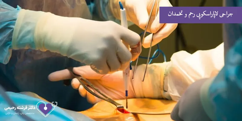 جراحی-لاپاراسکوپی-رحم-و-تخمدان