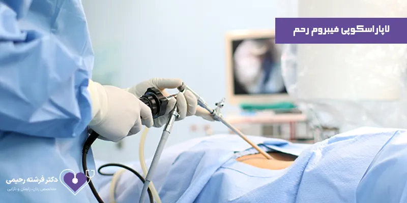 لاپاراسکوپی-فیبروم-رحم
