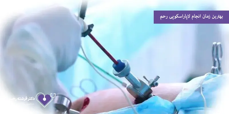 بهترین-زمان-انجام-لاپاراسکوپی-رحم