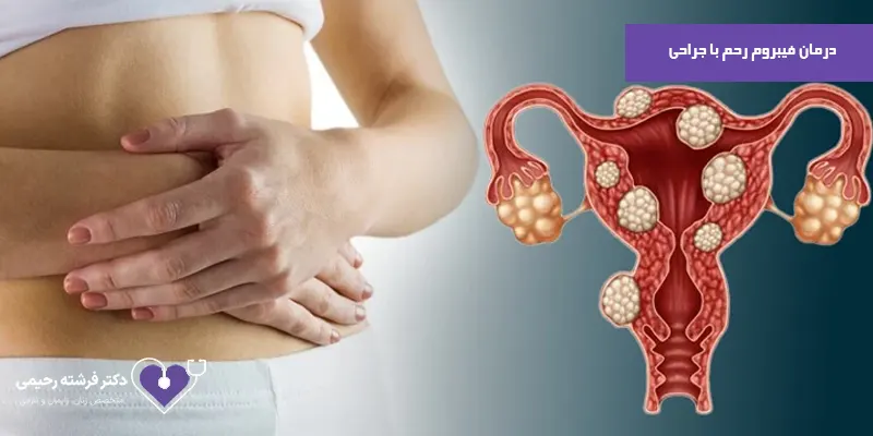 درمان-فیبروم-رحم-با-جراحی