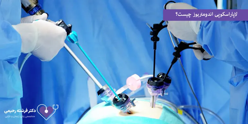 لاپاراسکوپی اندومتریوز چیست؟