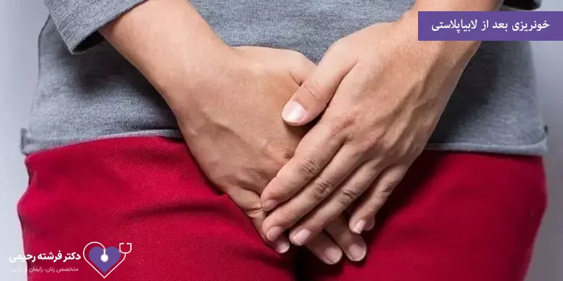 خونریزی بعد از لابیاپلاستی