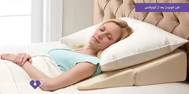 طرز خوابیدن بعد از لابیاپلاستی