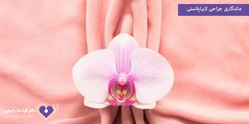 ماندگاری جراحی لابیاپلاستی