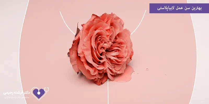 بهترین سن عمل لابیاپلاستی