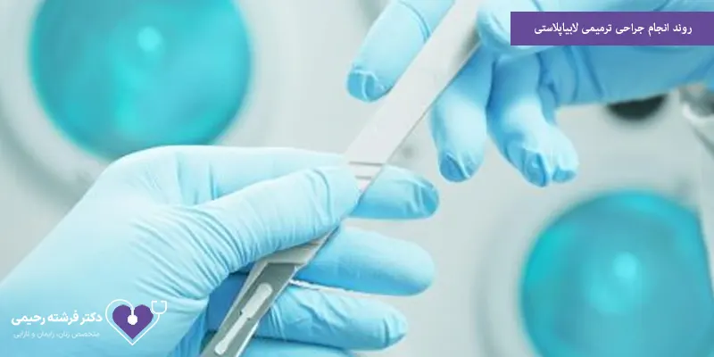 روند انجام جراحی ترمیمی لابیاپلاستی