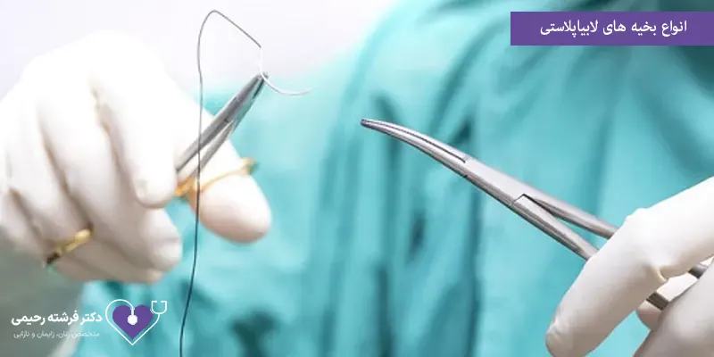 انواع بخیه‌ های لابیاپلاستی