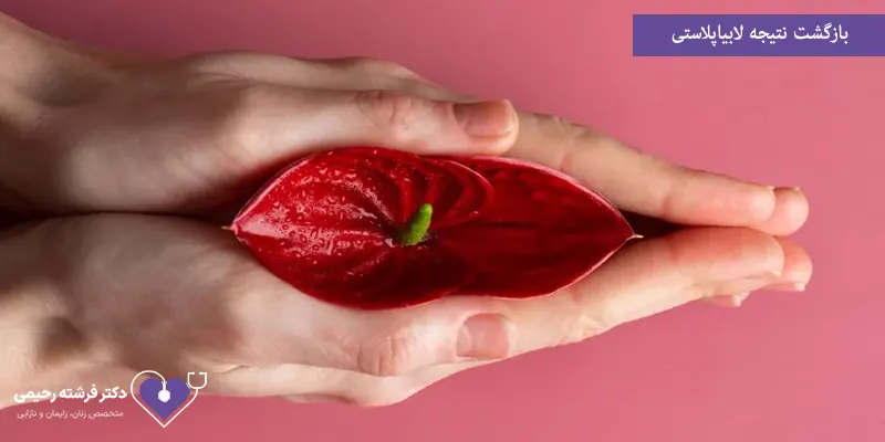 بازگشت نتیجه لابیاپلاستی