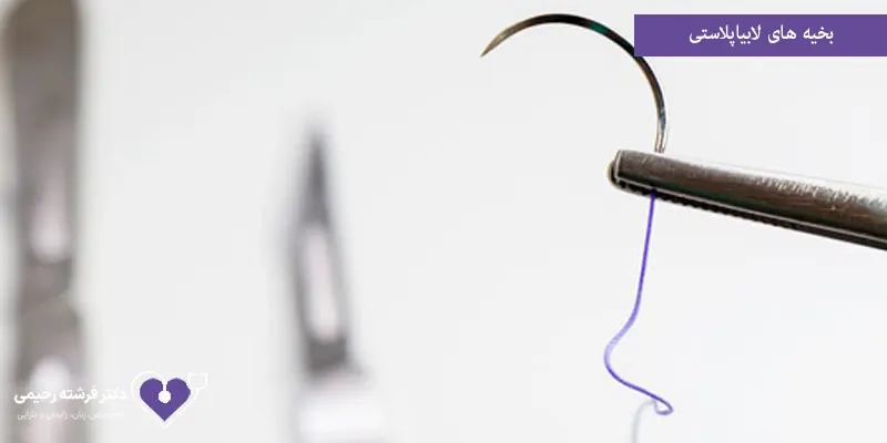 بخیه های لابیاپلاستی