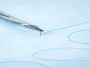 بخیه‌های لابیاپلاستی