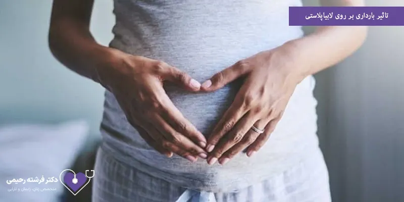 تاثیر بارداری بر روی لابیاپلاستی