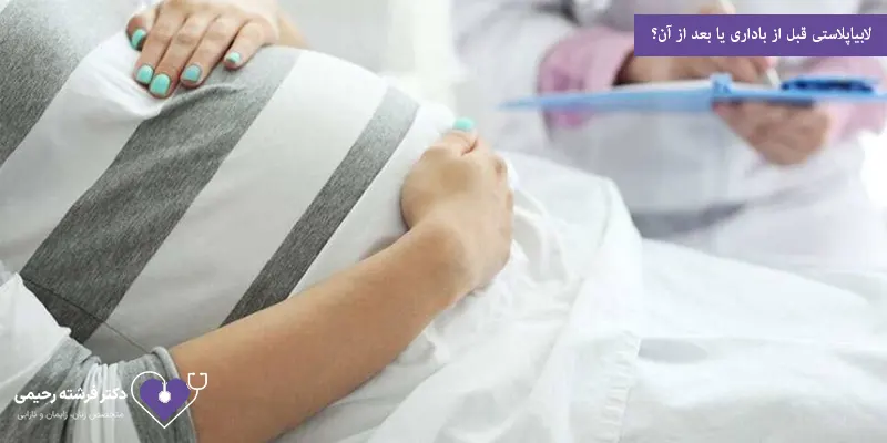 لابیاپلاستی قبل از باداری یا بعد از آن؟