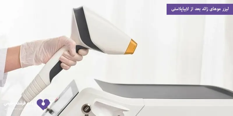 لیزر موهای زائد بعد از لابیاپلاستی