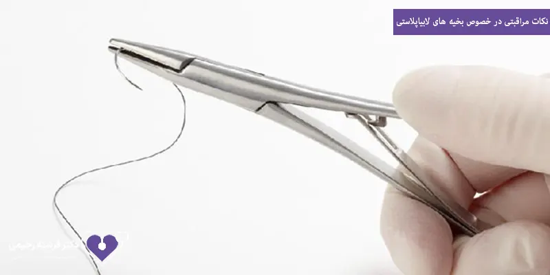 نکات مراقبتی در خصوص بخیه های لابیاپلاستی