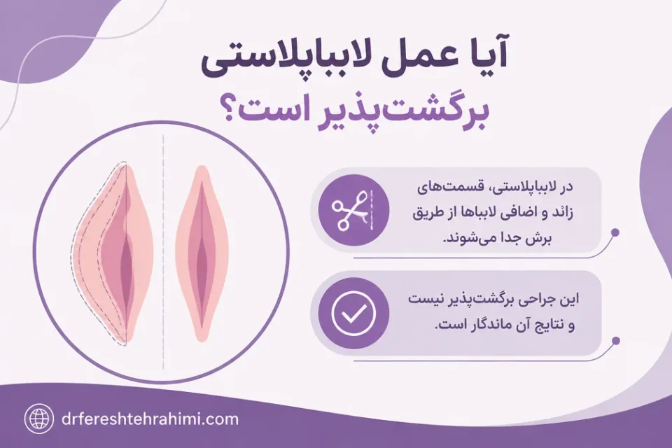نمای توضیحی درباره آیا عمل لابیاپلاستی برگشتپذیر است